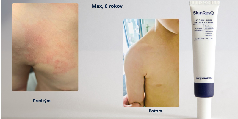 Foto Max